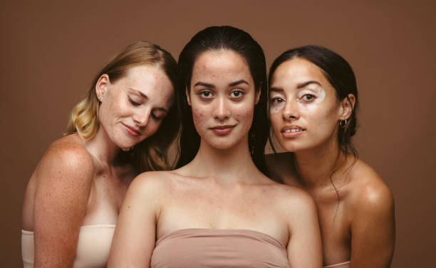 istock Woman embracing their imperfections 1331273203