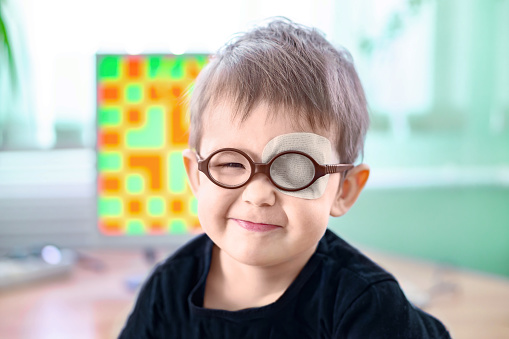 A little boy wearing glasses and an eye patch (plaster, occluder). Apes or grimaces. He undergoes vision treatment to prevent amblyopia and strabismus (squint, lazy eye). Child congenital vision disease problem.