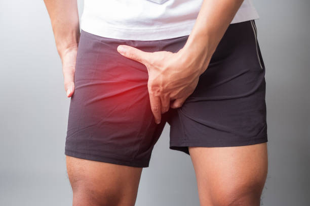 maschio adulto con dolore muscolare durante la corsa. corridore hanno mal di gamba a causa di groin pull, sindrome della banda liotibiale (itbs) o cancro alla prostata. infortuni sportivi e concetto medico - human groin foto e immagini stock