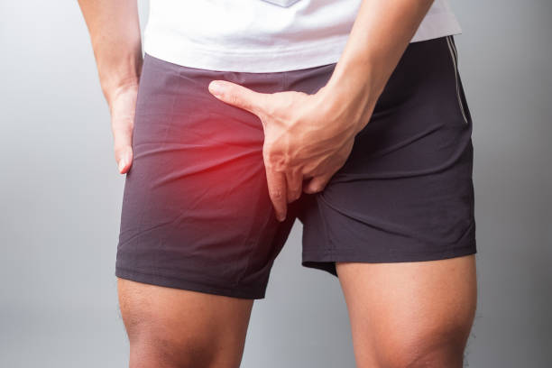 실행 하는 동안 근육 통 성인 남성. 주자는 사타구니 풀, 라이시알 밴드 증후군 (itbs) 또는 전립선 암으로 인해 다리 통증이 있습니다. 스포츠 부상 및 의료 개념 - human groin 뉴스 사진 이미지