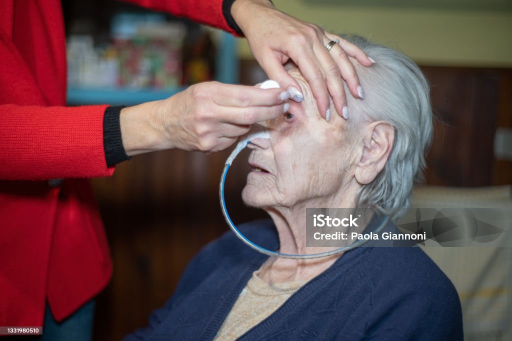 Family caring for family. Daughter putting eye drops in elderly mom's eyes with N.G. tube for dysphagia Family caring for family. Daughter putting eye drops in elderly mom's eyes with N.G. tube for dysphagia. Nasogastric Tube Stock Photo