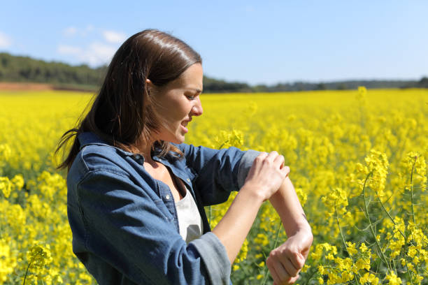 Woman scratching arm in a field on summer Woman scratching arm in a field on summer stinging stock pictures, royalty-free photos & images