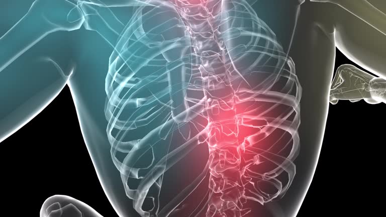 3,107 Osteoporosis Stock Videos and Royalty-Free Footage - iStock | Osteoporosis bone, Bone density, Bone 3,107 Osteoporosis Stock Videos and Royalty-Free Footage - iStock | Osteoporosis bone, Bone density, Bone