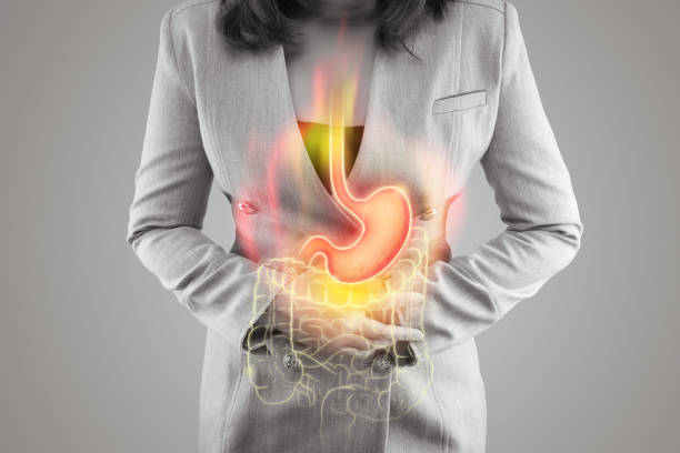 Acid reflux and Heartburn The illustration of stomach and large intestine is on the woman's body against gray background. Acid reflux. Female anatomy heartburn photos stock pictures, royalty-free photos & images