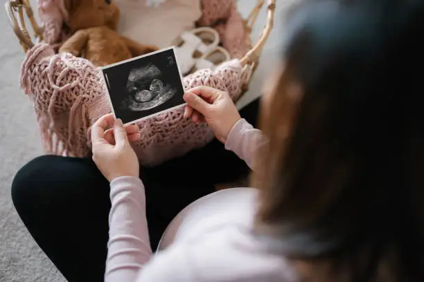 Close up of pregnant woman holding an ultrasound scan photo of her baby, with a moses basket filling with baby clothing, baby shoes and soft toy teddy bear in front of her. Mother-to-be. Expecting a new life. Preparing for the new born concept