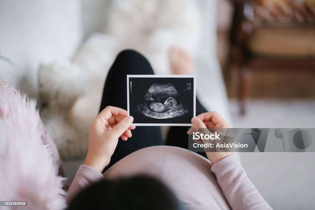 Young Asian pregnant woman lying on sofa at home, looking at the ultrasound scan photo of her baby. Mother-to-be. Expecting a new life concept Pregnant Stock Photo