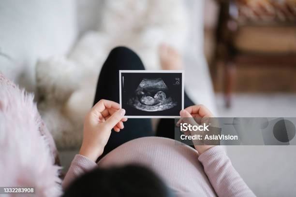 Young Asian Pregnant Woman Lying On Sofa At Home Looking At The Ultrasound Scan Photo Of Her Baby Mothertobe Expecting A New Life Concept Stock Photo - Download Image Now