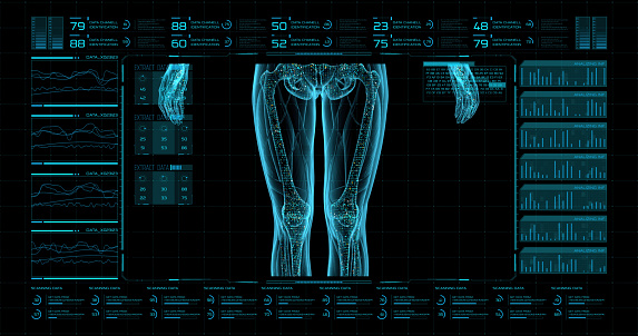 The hud interface of the futuristic medical program is a scanner control panel (MRI) with digital three-dimensional visualization of bones, as well as soft tissues that are around them.