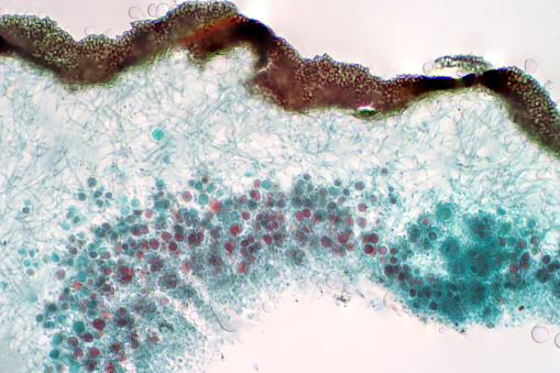 Lichen, Fungus, cross section slide under the light microscope view for education biology.