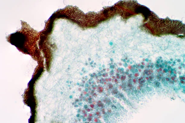 istock Lichen, Fungus, cross section slide under the light microscope view for education biology. 1332594740