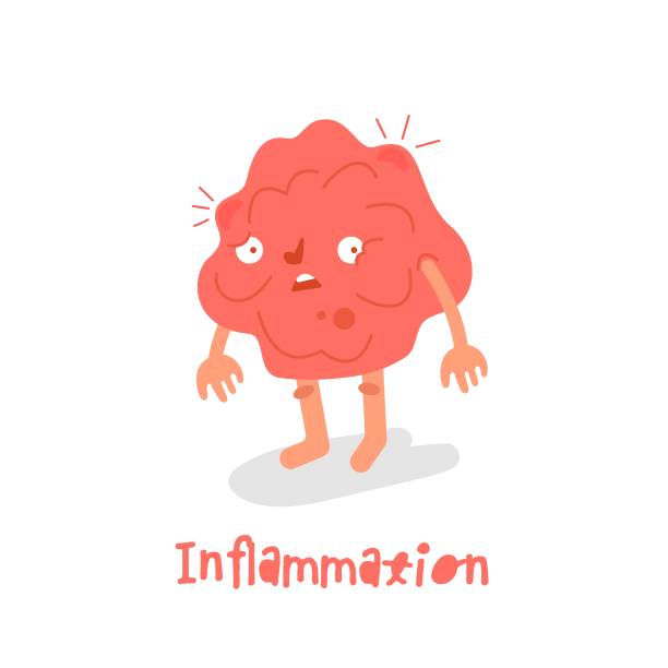 1,929 Chronic Inflammation Illustrations & Clip Art - iStock | Chronic  inflammation concept