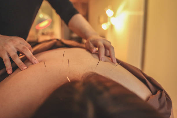 gros plan sur l’acupuncture corporelle en tant que médecine alternative - massaging massage therapist rear view human hand photos et images de collection