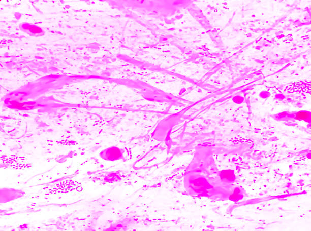 gram positivo diplococchi, canne gram negative e candida albican. - bacterium staphylococcus colony epidemic foto e immagini stock