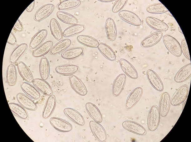 腸炎(ev)卵。便中の寄生虫、光顕微鏡40x目的下の画像。 - educational subject scientific micrograph micro organism medical exam ストックフォトと画像