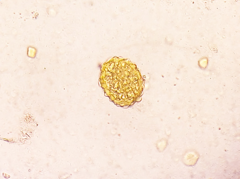 Ascaris lumbricoides (AL) egg; parasite in stool, image under light microscopy at medical laboratory.