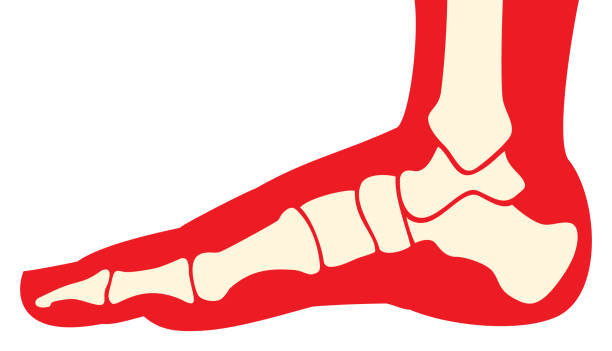 인간의 발 해부학 - bunion bunions human foot podiatry stock illustrations