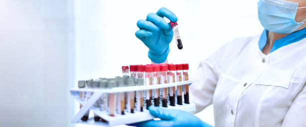 ręce asystenta laboratoryjnego podczas pracy z badaniami krwi w probówkach. - microbiology analyzing laboratory scrutiny zdjęcia i obrazy z banku zdjęć