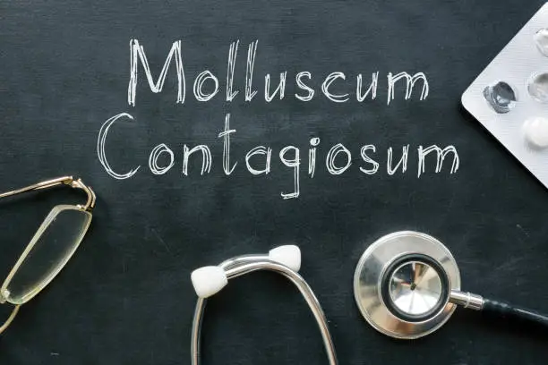 Molluscum contagiosum is shown on a medical photo using the text