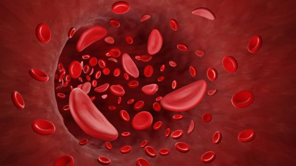 혈류에 있는 겸상적혈구 - human blood cell 뉴스 사진 이미지