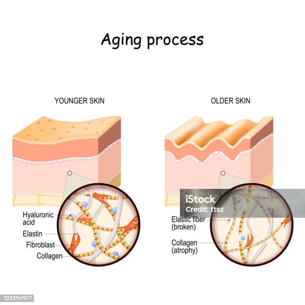 Aging Process Map Aging Process Stock Illustration - Download Image Now - Skin, Aging ...