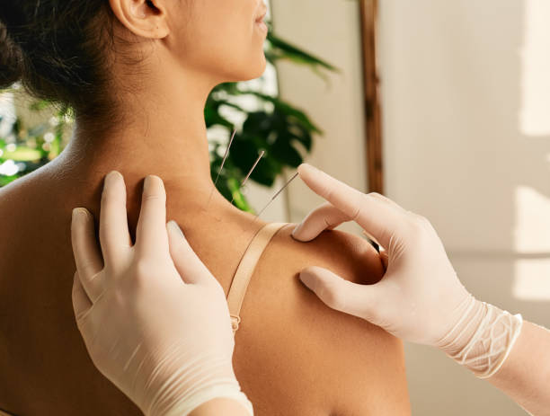 istock Reflexologist hand with acupuncture needle close-up during insert needle into a woman's shoulder for treatment. Acupuncture, reflexology 1333182971