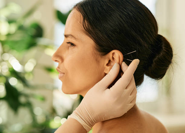 femme ayant une acupression de l’oreille ou de l’acupuncture de l’oreille pour son traitement des maladies, vue de côté. acupuncture, réflexologie, médecine traditionnelle chinoise - acupuncture needle photos et images de collection