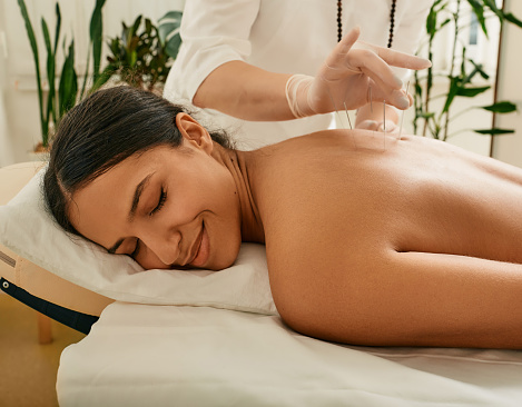 Alternative medicine, reflexology. Treatment of back pain with acupuncture needles for female patient. Traditional Chinese Medicine