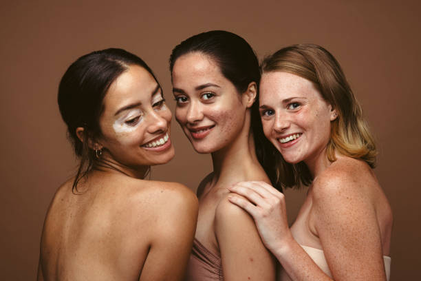 Being happy with your flaws and imperfections Close up of three women having skin problems standing together on brown background. Confident young women with skin imperfections reflecting body positivity and self acceptance. semi dress stock pictures, royalty-free photos & images
