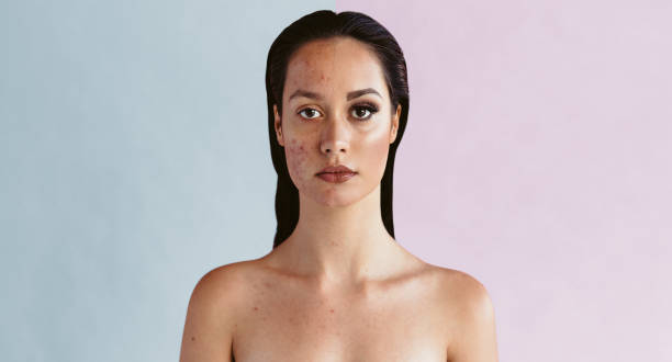 istock Power of makeup and retouching 1333400516