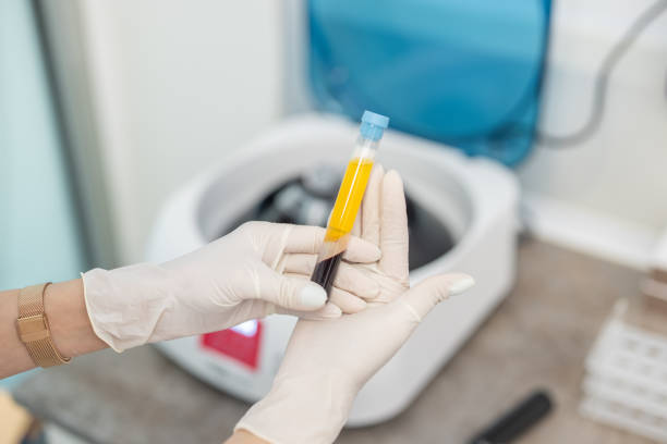 Close up od doctor's hands while preparing blood collection tubes for centrifuge machine stock photo