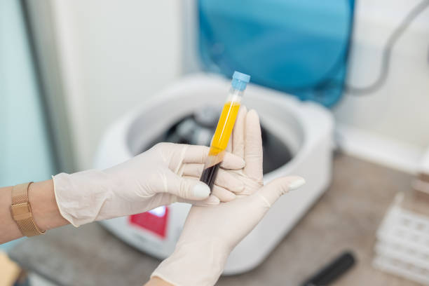 Close up od doctor's hands while preparing blood collection tubes for centrifuge machine Close up od doctor's hands with surgical gloves while preparing blood collection tubes for centrifuge machine blood plasma stock pictures, royalty-free photos & images