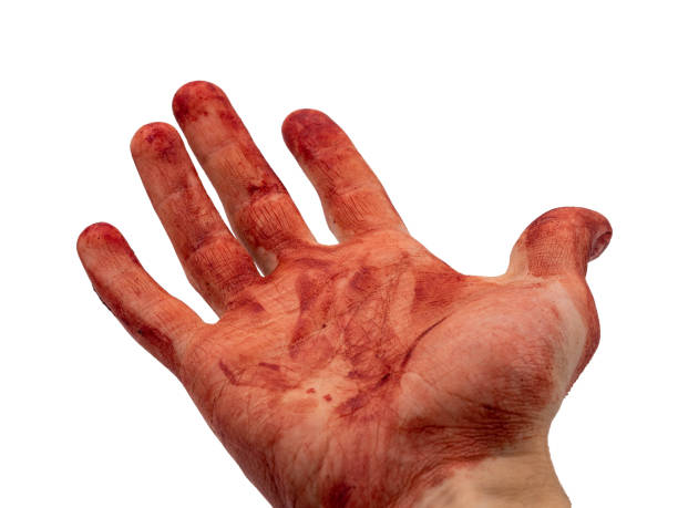 istock The concept of a beggar asking for medical help. 1333524620