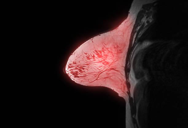 brust-mrt oder magnetresonanztomographie axial t1w der brust bei frauen zum screening von brustkrebs. - mammogram mri scan breast breast examination stock-fotos und bilder