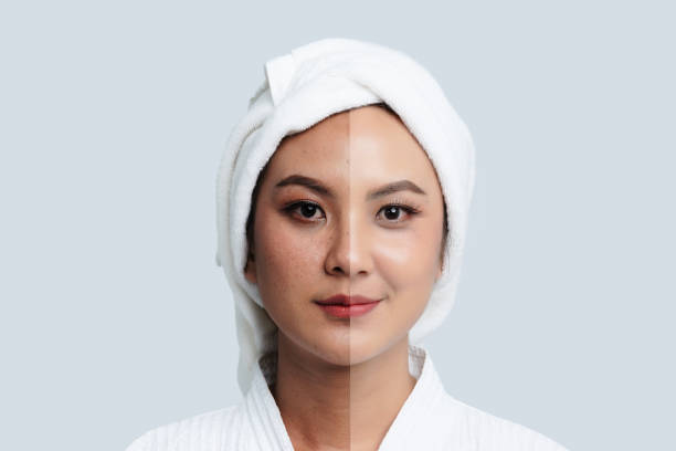 Comparison Portrait of Beautiful Asian woman. Dark spots and new skin, Before - After skin care and clean concept, Beauty treatment process of aging for rejuvenation. stock photo