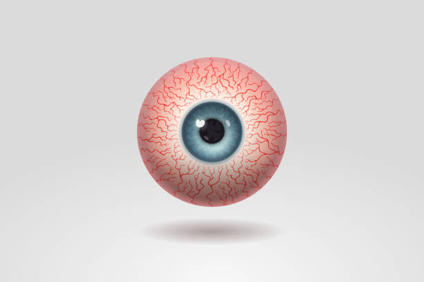 Reddened human eyeball with many distinct blood vessels vector art illustration