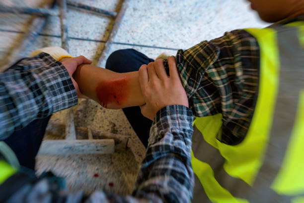 infortunio sanguinante da incidente sul lavoro in pila di acciaio per ponteggi che cade per impattare il braccio del giovane costruttore. aggiungi il filetto di zoom per il movimento emotivo. - insurance healthcare and medicine industry damaged foto e immagini stock