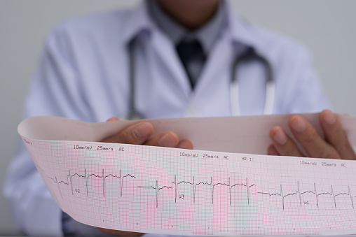 Close up of male cardiologist doctor or medical student in white coat with stethoscope holding and reading ekg paper print report of heart disease patient