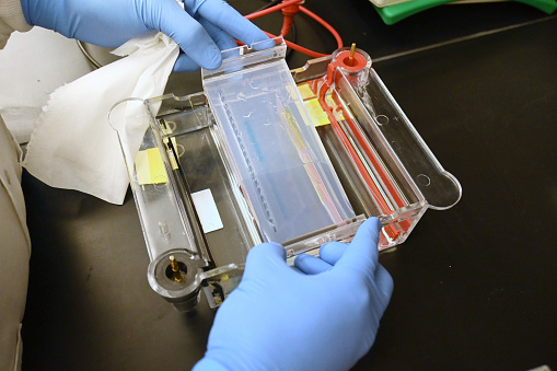 Scientist performing gel electrophoresis