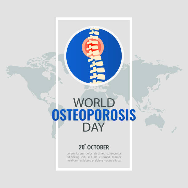 World Osteoporosis Day. Vector Illustration of World Osteoporosis Day. osteoporosis awareness stock illustrations