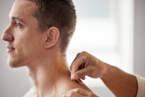 istock Shot of a young man getting acupuncture 1334611190
