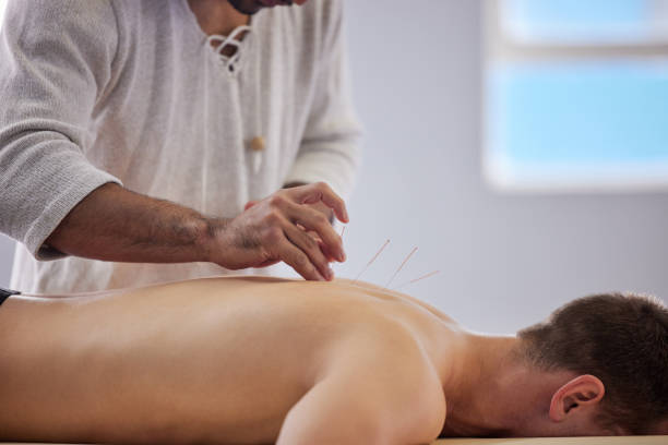 colpo di agopunturista che tratta un cliente - massaging spa treatment health spa men foto e immagini stock
