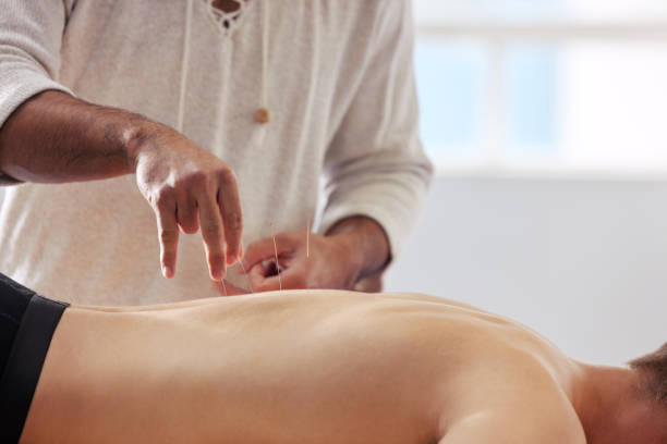 istock Shot of a acupuncturist treating a client 1334611633