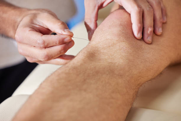 istock Shot of a acupuncturist treating a client 1334611859