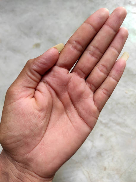 istock Hand Large Nail And Hand Fingers Photos  Selective Focus 1334697611
