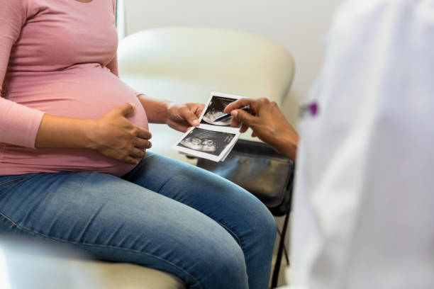 médica irreconhecível aponta para foto de ultrassom paciente está segurando - midwife human pregnancy women multi ethnic group - fotografias e filmes do acervo