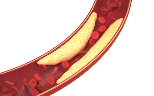 Fat and red blood cells in blood vessels, 3d rendering. Fat and red blood cells in blood vessels, 3d rendering. Computer digital drawing. atherosclerosis stock pictures, royalty-free photos & images