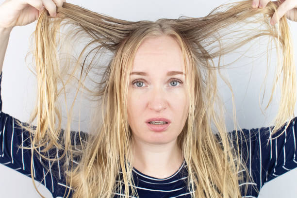 Thinning Hair In Middle Age Stock Photos, Pictures & Royalty-Free Images - iStock Thinning Hair In Middle Age Stock Photos, Pictures & Royalty-Free Images - iStock