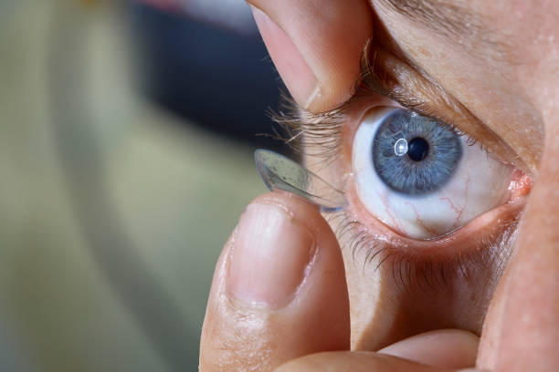 istock Man putting in contact lens in his eye 1335058189