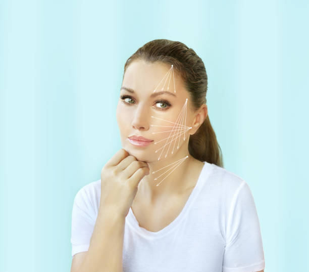 istock thread lift procedure ,non-surgical facelift,markup 1335208315