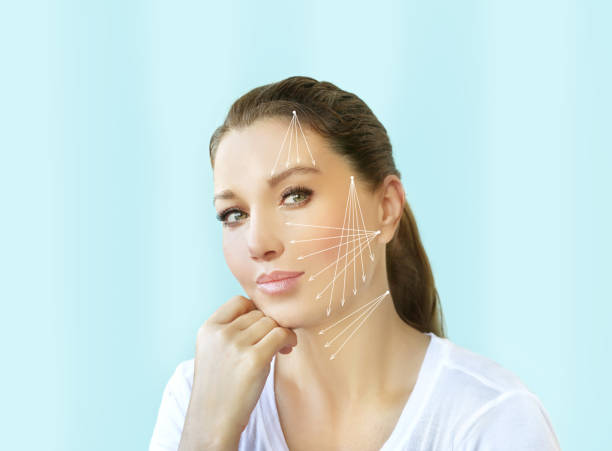 istock thread lift procedure ,non-surgical facelift,markup 1335208316